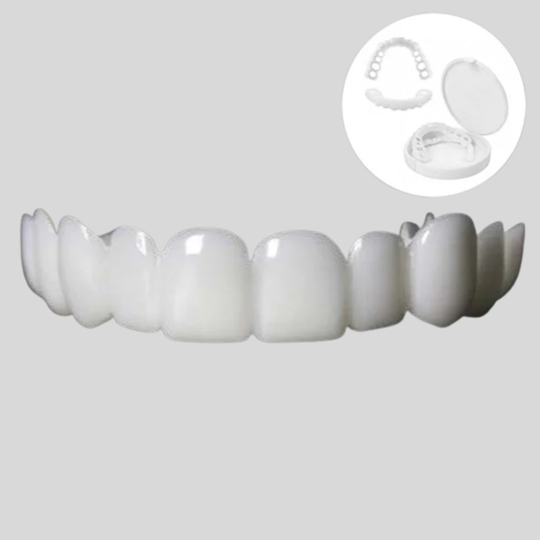 Facettes Snap-On pour améliorer le sourire